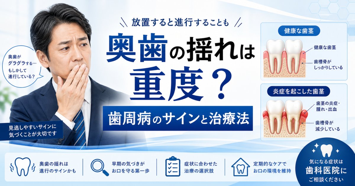 奥歯の揺れは重度?40代が抜歯を避けるための歯周病サインと治療法