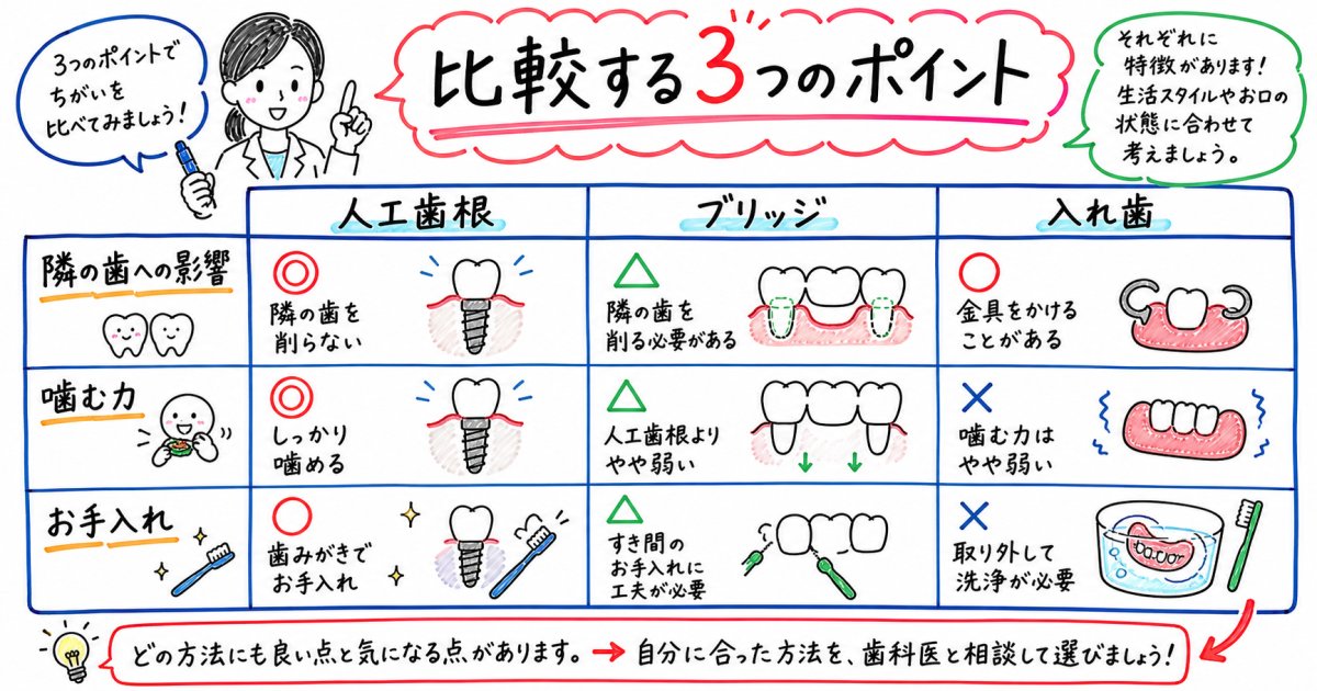 人工歯根(インプラント)の基礎知識と顎の骨に固定される仕組み