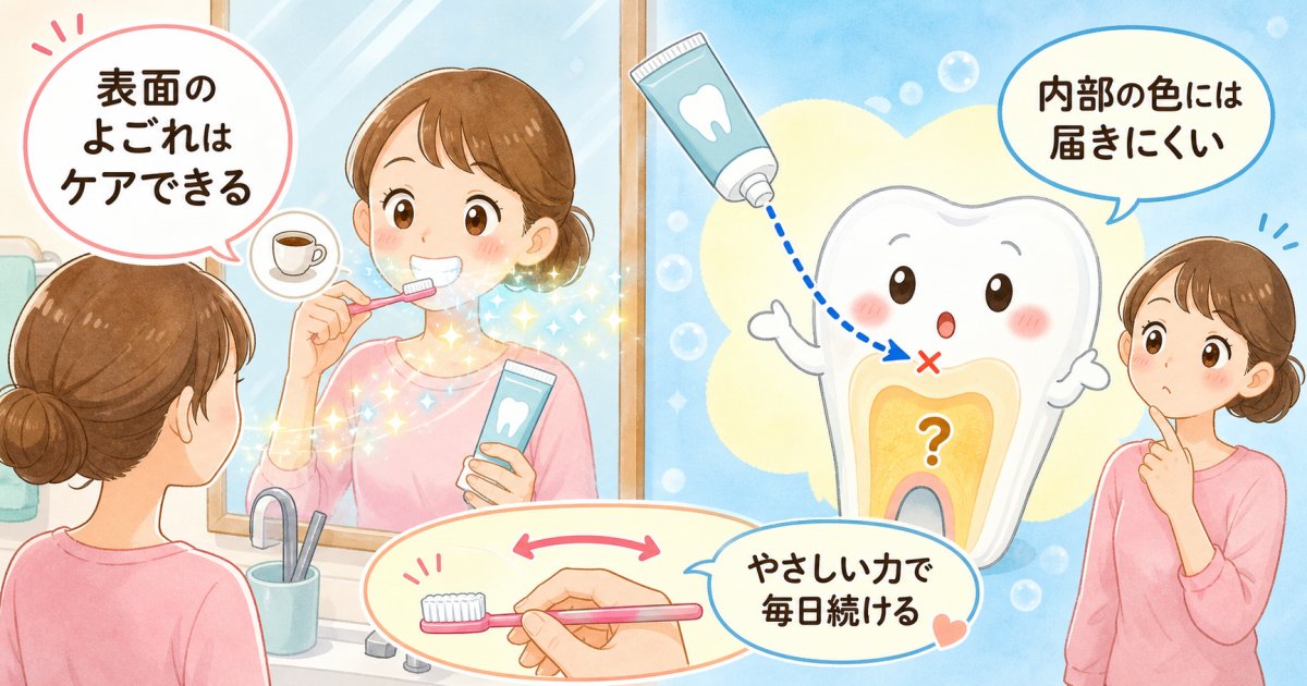 市販のホワイトニングケアで落ちる黄ばみと落ちない黄ばみの限界