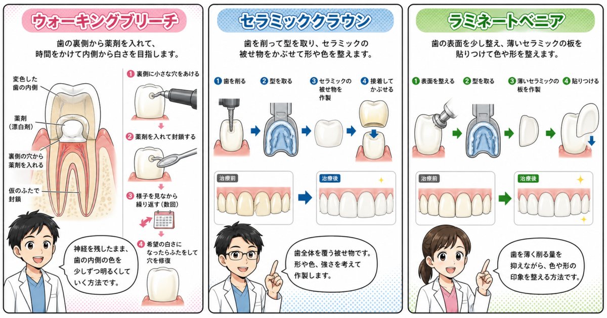 神経を抜いた歯が黒く変色する仕組みと放置するリスク