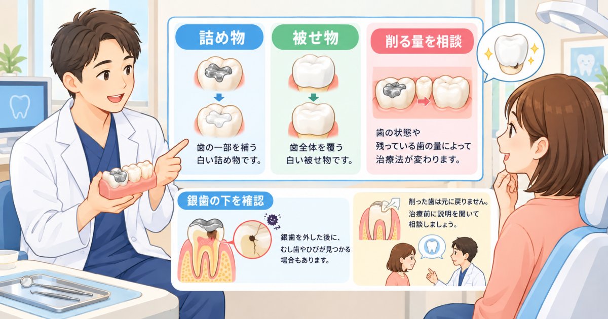 奥歯の銀歯を白くするには、歯をどれくらい削る?