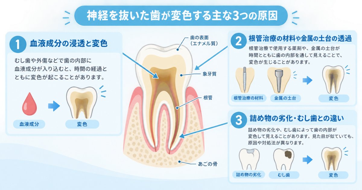 神経を抜いた歯はなぜ黒く変色するの?